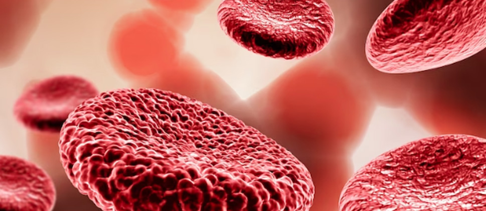 Luego de más de dos siglos, la hemofilia sigue rodeada de mitos