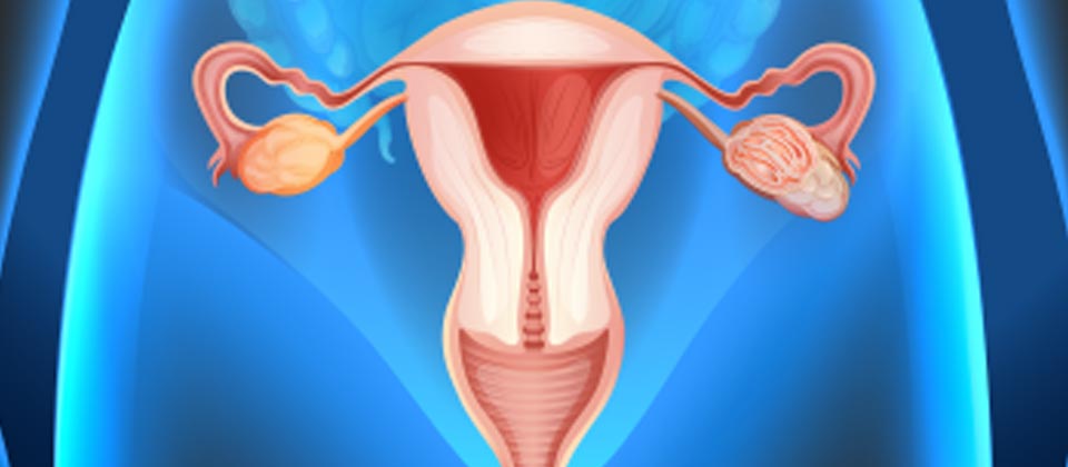 El uso de anticonceptivos puede disminuir el riesgo de cáncer de ovario